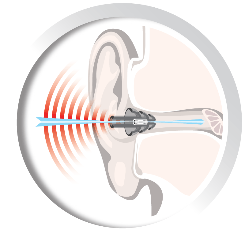 Auritech Shooting Ear Plugs-3